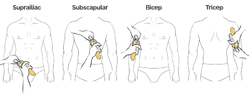 4-site bodyfat percentage measurement